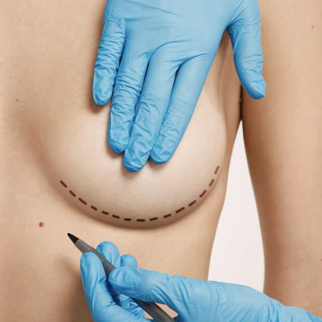 Mole and skin tag removal — Robinson Facial Plastic Surgery