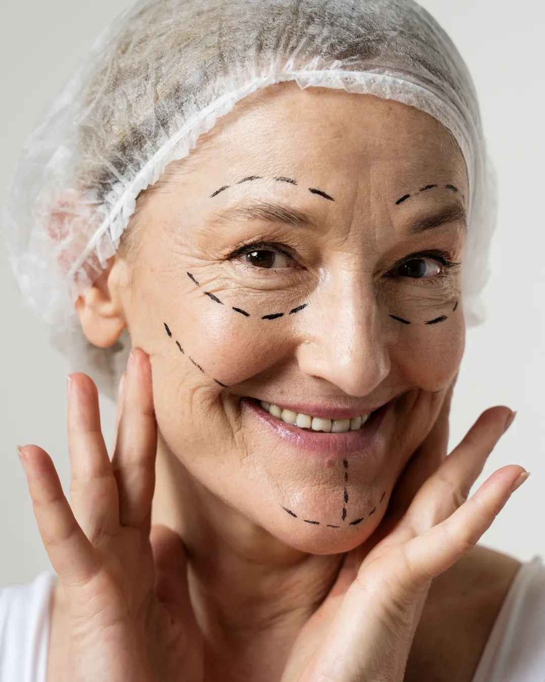 Chin Implant
