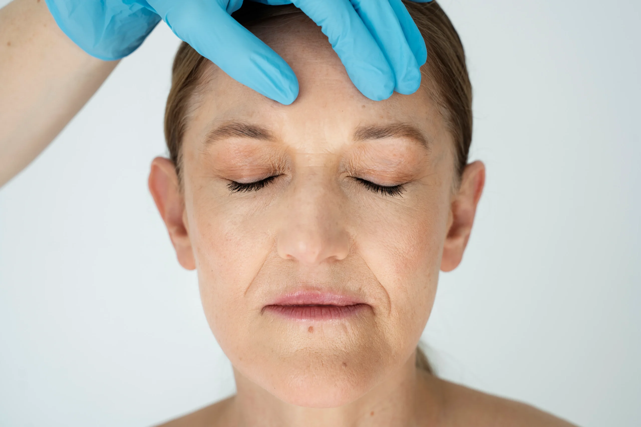 Botox for migraine headaches — Robinson Facial Plastic Surgery